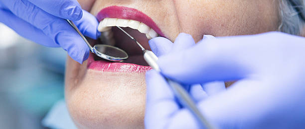 Best Emergency Denture Repair in Heber, UT